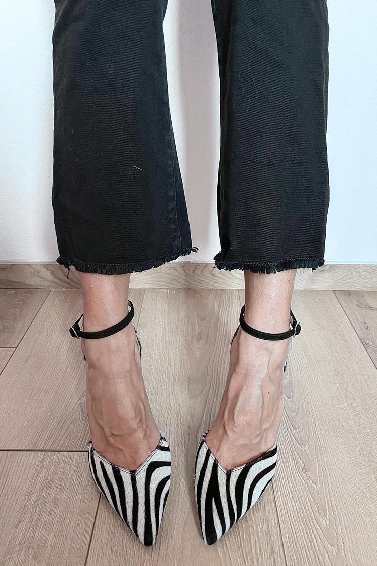 Caterina | Ankle Pumps